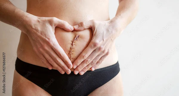 Husband Feels Stitches After Hysterectomy: Know Why